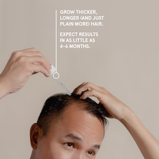 Foto 6 | Foto 6 | El Sérum Para El Crecimiento Del Cabello Mantiene El Minoxidil 5% Extra Fuerte Para Hombres - Venta Internacional.
