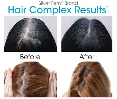 Foto 6 | Foto 6 | Suplemento Capilar Silver Fern Hair Complex, 2 Botellas - Venta Internacional.