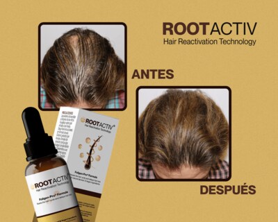 Foto 5 | Foto 5 | Loción Para La Caída Del Cabello Con Gotero Rootactiv Capilia Longa + Niacinamida Frasco Con 50 Ml.