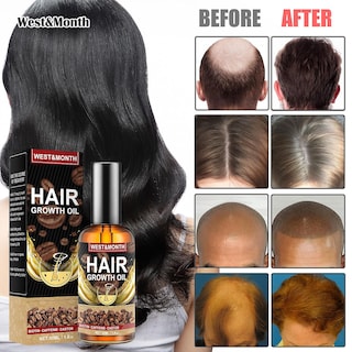 Foto 3 | Foto 3 | Aceite Para El Crecimiento Del Cabello Huoguo Cafeína 50 Ml Para Reparar El Cabello Dañado - Venta Internacional.