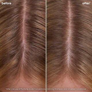 Foto 2 | Foto 2 | Shampoo Biolage Scalp Sync Calming Que Calma E Hidrata El Cuero Cabelludo - Venta Internacional