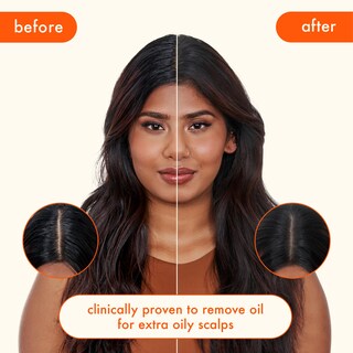 Foto 6 | Foto 6 | Champú Seco Amika Perk Up Ultra Oil Control 150 ml - Venta Internacional