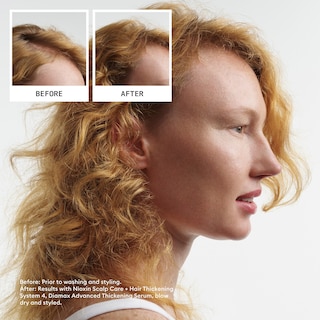 Foto 3 | Foto 3 | Champú Nioxin System 4 Para Espesar El Cuero Cabelludo Y El Cabello, 1 Litro - Venta Internacional.
