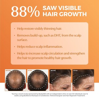 Foto 4 | Foto 4 | Champú Bosleymd Bosrevive Nutritivo 300 Ml Para Cabello Fino - Venta Internacional.