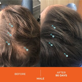 Foto 3 | Foto 3 | Champú Ds Laboratories Revita Hair Growth 180 Ml - Venta Internacional.