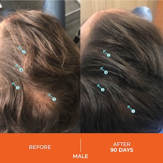 Foto 3 | Foto 3 | Champú Ds Laboratories Revita Hair Growth 414 Ml, Unisex - Venta Internacional.