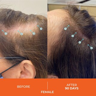 Foto 2 | Foto 4 | Champú Ds Laboratories Revita Hair Growth 414 Ml, Unisex - Venta Internacional.