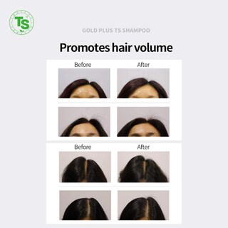 Foto 5 | Foto 5 | Champú Gold Plus Ts Para Crecimiento Y Grosor Del Cabello, 500 Ml Con Biotina - Venta Internacional.