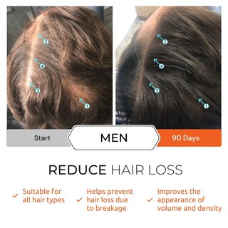 Foto 5 | Foto 5 | Champú Ds Laboratories Revita Para El Crecimiento Del Cabello, Bloqueador De Dht, 180 Ml - Venta Internacional.