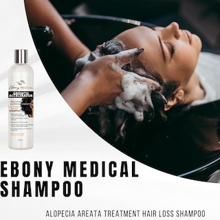 Foto 4 | Foto 4 | Champú Ebony Medical Growth Accelerator Para Tratamiento De Alopecia - Venta Internacional.