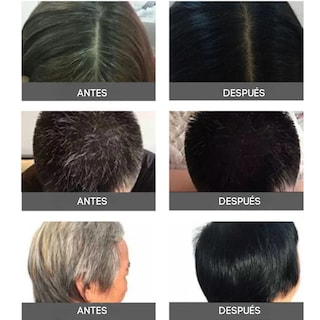 Foto 7 | Foto 7 | Shampoo Tinte Cubre Canas Natural 500ml Cambio Color Cabello (color Marron)