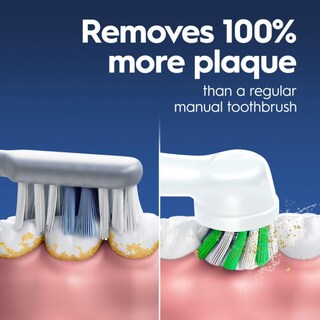 Foto 2 | Foto 2 | Cepillo De Dientes Eléctrico Oral-b Genius X Limited Con 1 Cabezal Blanco - Venta Internacional.