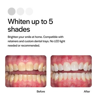 Foto 3 | Foto 3 | Kit De Recambio Para Blanqueamiento Dental Opalescence Con Peróxido De Carbamida Al 20% - Venta Internacional.