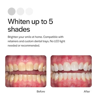 Foto 3 | Foto 3 | Kit De Recambio Para Blanqueamiento Dental Opalescence Gel Al 15% 8 Jeringas - Venta Internacional.