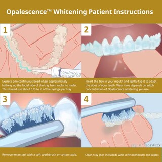 Foto 6 | Foto 6 | Jeringas De Gel Blanqueadoras De Dientes Opalescence Quick Pf 45% (12) - Venta Internacional.