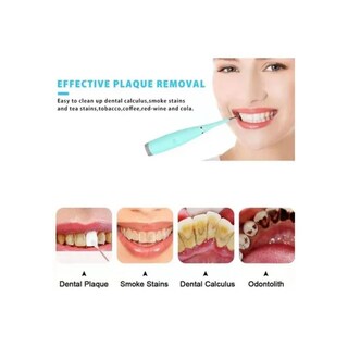Foto 5 | Foto 5 | Limpiador De Dientes Blanqueador Ifanze Garro Quitamanchas - Venta Internacional.