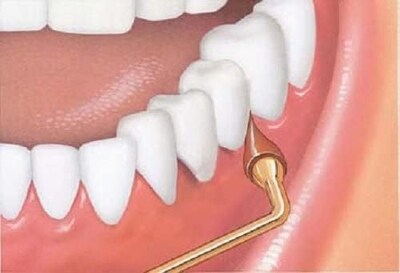 Foto 3 | Foto 3 | El Estimulador Gum Rellena 3 Puntas De Goma Para Un Agarre Permanente - Venta Internacional.