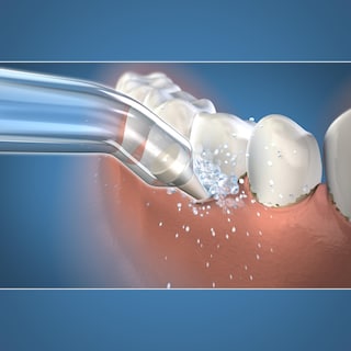 Foto 4 | Foto 4 | Consejos Para Reemplazar El Hilo Dental Waterpik Pink Pocket Pp-100e - Venta Internacional.
