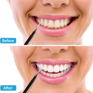 Foto 6 | Foto 6 | Cepillo Interdental Patelai, 100 Piezas, Hilo Dental - Venta Internacional.