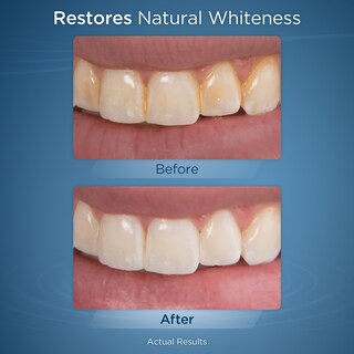 Foto 5 | Foto 5 | Tabletas De Recarga Waterpik Fresh Mint Whitening (30 Unidades) - Venta Internacional.