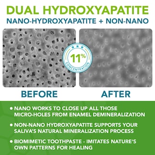 Foto 3 | Foto 3 | Pasta Dental Great Oral Health Nano Hidroxiapatita de 113 g-Venta Internacional