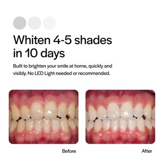 Foto 4 | Foto 4 | Kit de Blanqueamiento Dental Opalescence Go 15% Mint con 10 Bandejas - Venta Internacional