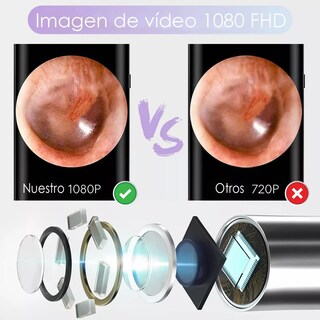 Foto 4 | Foto 4 | Limpiador Oídos Cámara Quita Cerilla Inteligente Endoscopio Multicolor Belug