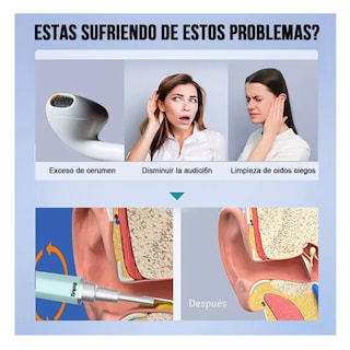Foto 4 | Foto 4 | Limpiador De Oídos Con Cámara, Quita Cerilla Inteligente Endoscopio Belug, Verde/plata