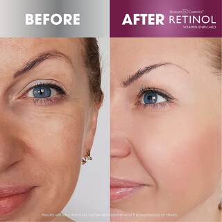 Foto 5 | Foto 5 | Toallitas Limpiadoras Con Retinol Antienvejecimiento Y Vitaminas A Y E - Venta Internacional.