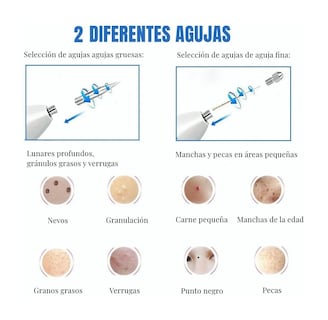 Foto 3 | Foto 3 | Pluma Cauterizadora de Verrugas y Pecas Malubero color Blanco