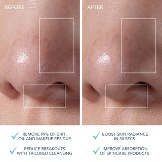 Foto 5 | Foto 5 | Cepillo De Limpieza Facial De Silicona Foreo Luna Mini 3 Mint - Venta Internacional.