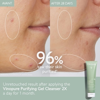 Foto 2 | Foto 2 | Gel Purificador De Poros Cleanser Caudalie Vinopure, 150 Ml - Venta Internacional.