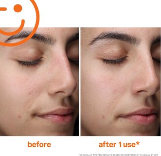 Foto 5 | Foto 5 | Limpiador Facial Kate Somerville Exfolikate De 50 Ml Con Aha - Venta Internacional.