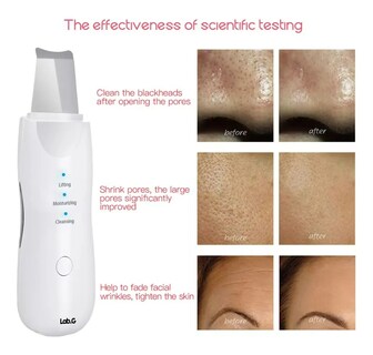 Foto 2 | Foto 2 | Limpiador Facial Ultrasonico Lab.g Skin Scrubber Exfoliador Piel Blanco