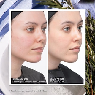 Foto 5 | Foto 5 | Crema Espumosa De Yogur Griego Cleanser Korres 75 Ml - Venta Internacional.
