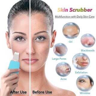 Foto 4 | Foto 4 | Limpiadores Faciales Espátula Facial Vibratoria Eliminador De Puntos Negros - Venta Internacional.