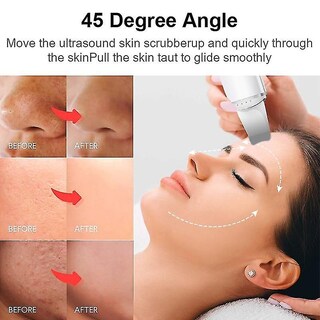 Foto 5 | Foto 5 | Limpiadores Faciales Depurador Ultrasónico De Piel Eliminador De Puntos Negros - Venta Internacional.