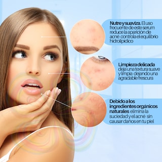 Foto 7 | Foto 7 | Kit Cuidado Facial Espuma Limpiadora Serum Y Crema Anti Acné