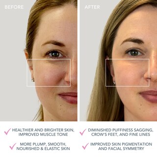 Foto 5 | Foto 5 | Dispositivo Facial Foreo Bear Mini Para Esculpir La Cara Con Microcorriente - Venta Internacional.
