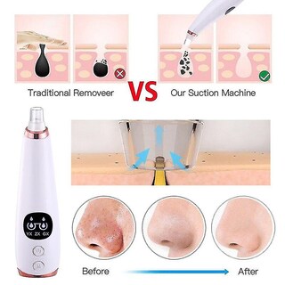 Foto 2 | Foto 2 | Limpiadores Faciales Para Eliminar Puntos Negros Carga Usb Uso Doméstico - Venta Internacional.