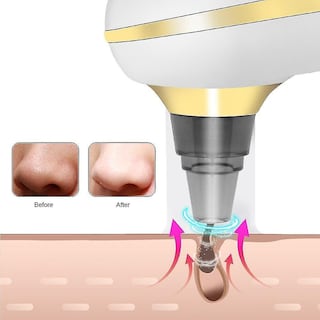 Foto 2 | Foto 2 | Limpiadores Faciales Con Aspiración Profunda Eliminador De Puntos Negros Mediante Usb - Venta Internacional.