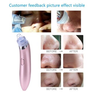 Foto 1 | Foto 1 | Beauty Device Blackhead Pore Cleaner Darwell Versión En Inglés - Venta Internacional.