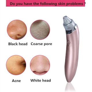 Foto 2 | Foto 2 | Beauty Device Blackhead Pore Cleaner Darwell Versión En Inglés - Venta Internacional.