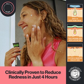 Foto 4 | Foto 4 | Tratamiento Localizado Oxy Advanced Care Maximum Strength Con Prebióticos - Venta Internacional.