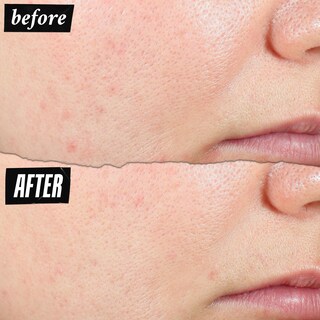 Foto 3 | Foto 3 | Crema Hidratante Kiehl's Expertly Clear Con 1,2% De Ácido Salicílico, 60 Ml - Venta Internacional.