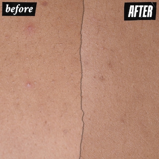 Foto 6 | Foto 6 | Crema Hidratante Kiehl's Expertly Clear Con 1,2% De Ácido Salicílico, 60 Ml - Venta Internacional.