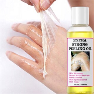 Foto 2 | Foto 2 | Aceite Exfoliante Amarillo Extra Fuerte 220 Ml Para Todo Tipo De Piel - Venta Internacional.