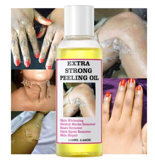 Foto 3 | Foto 3 | Aceite Exfoliante Amarillo Extra Fuerte 220 Ml Para Todo Tipo De Piel - Venta Internacional.