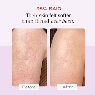 Foto 3 | Foto 3 | Exfoliante Corporal First Aid Beauty Kp Bump Eraser 120 Ml 10% Aha - Venta Internacional.