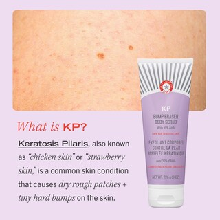 Foto 6 | Foto 6 | Exfoliante Corporal First Aid Beauty Kp Bump Eraser 120 Ml 10% Aha - Venta Internacional.